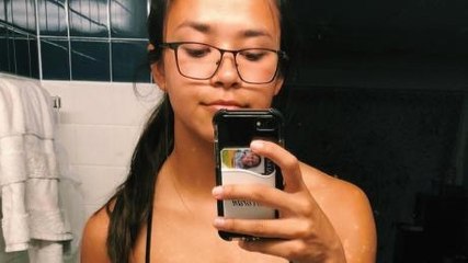 Tired of hiding because of her illness, she's finally showing her true face