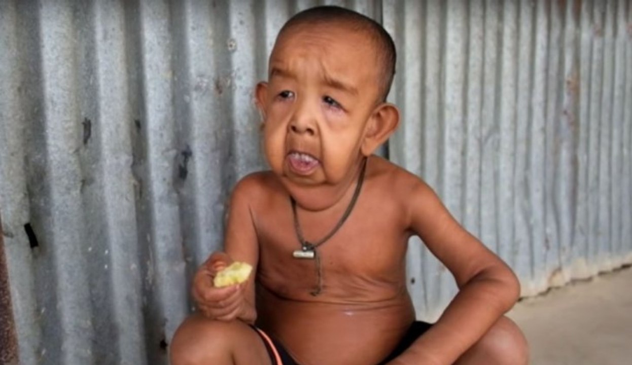 'Benjamin Button aus Bangladesh': Dieser kleine Junge sieht aus wie ein 80-Jähriger