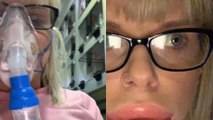 This woman was nicknamed 'sausage-mouth' after her lip procedure went horribly wrong