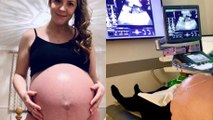 After Losing Her Baby at 18 Weeks, She Decided to Continue Her Pregnancy