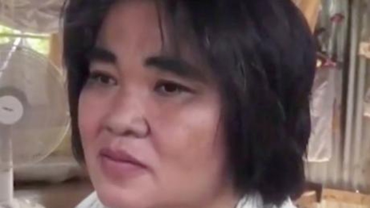 This woman's chest has been growing uncontrollably for over a year