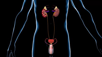 Urethral sounding: Is this extreme sexual act worth the risk?