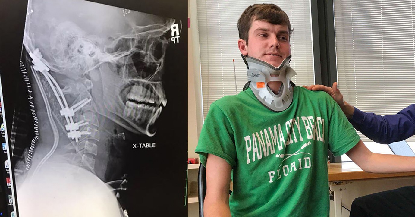 Nach Autounfall: 22-jähriger überlebt „innere Enthauptung“