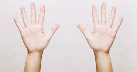 Nur etwa 3 % aller Menschen haben ein Zeichen mit einer ganz besonderen Bedeutung auf der Hand