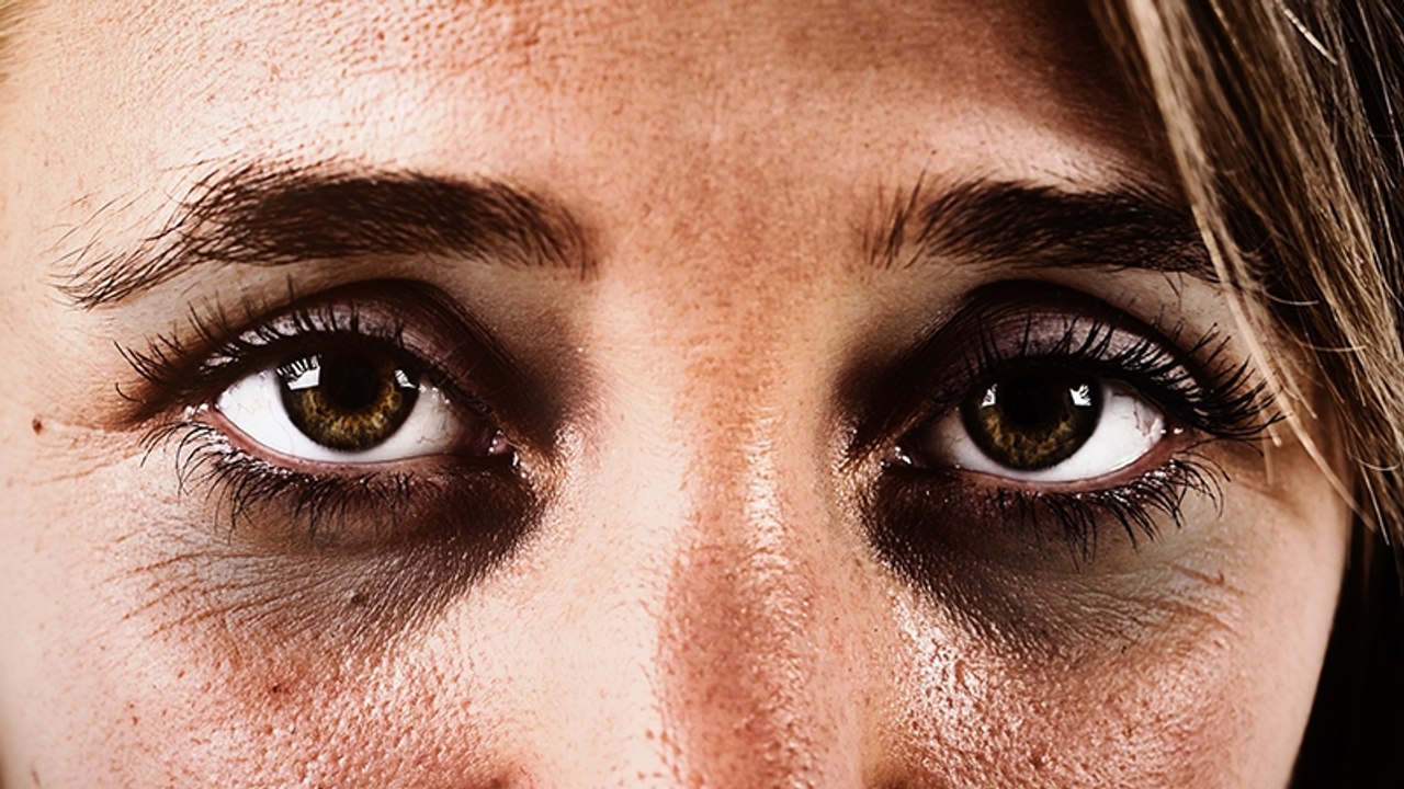 Eigentlich für andere Körperstelle: Diese Creme ist ein Wundermittel gegen Augenringe