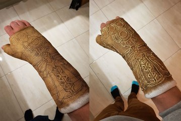 Avengers : il transforme son plâtre en gant de Thanos