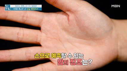 손 생김새로 암을 예측할 수 있다? 손으로 보는 건강