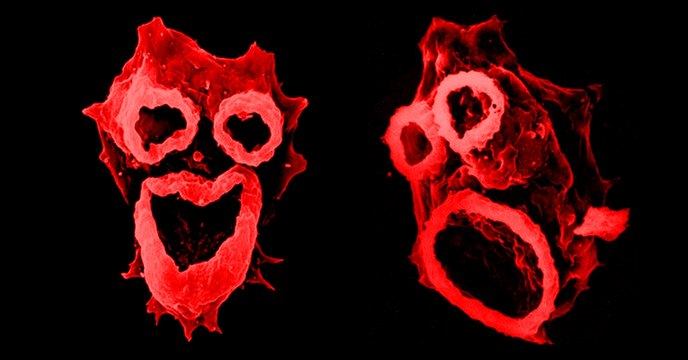 Hirnfresser-Amöben breiten sich immer weiter aus