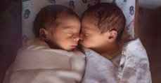 Sensation: Eineiige Zwillinge mit unterschiedlichen Geschlechtern stellen Ärzte vor Rätsel