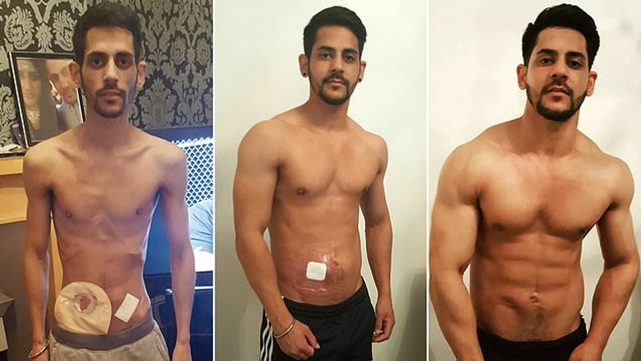 Von 29 Kilo Körpergewicht zum Powerlifting: Mann kämpft sich mit Sport zurück ins Leben