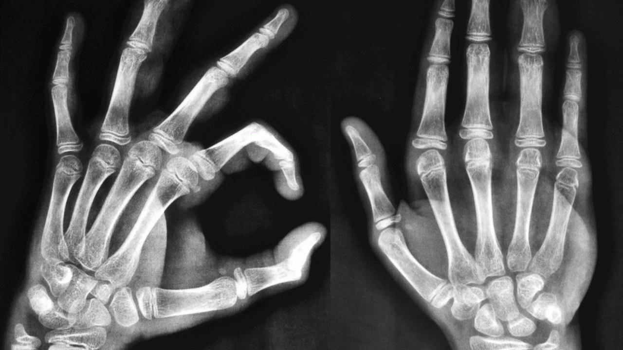 Anatomische Veränderungen: So verändert das Smartphone unser Aussehen