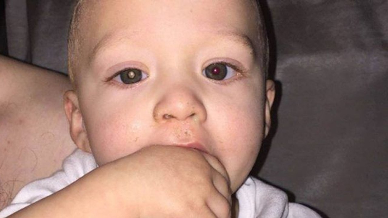 Mutter fotografiert ihr Kind: Detail enthüllt schlimme Krankheit