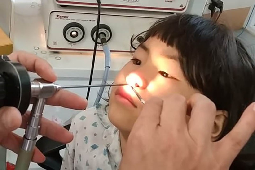 7-Jährige hat Nasenschmerzen: Der Arzt macht eine widerliche Entdeckung