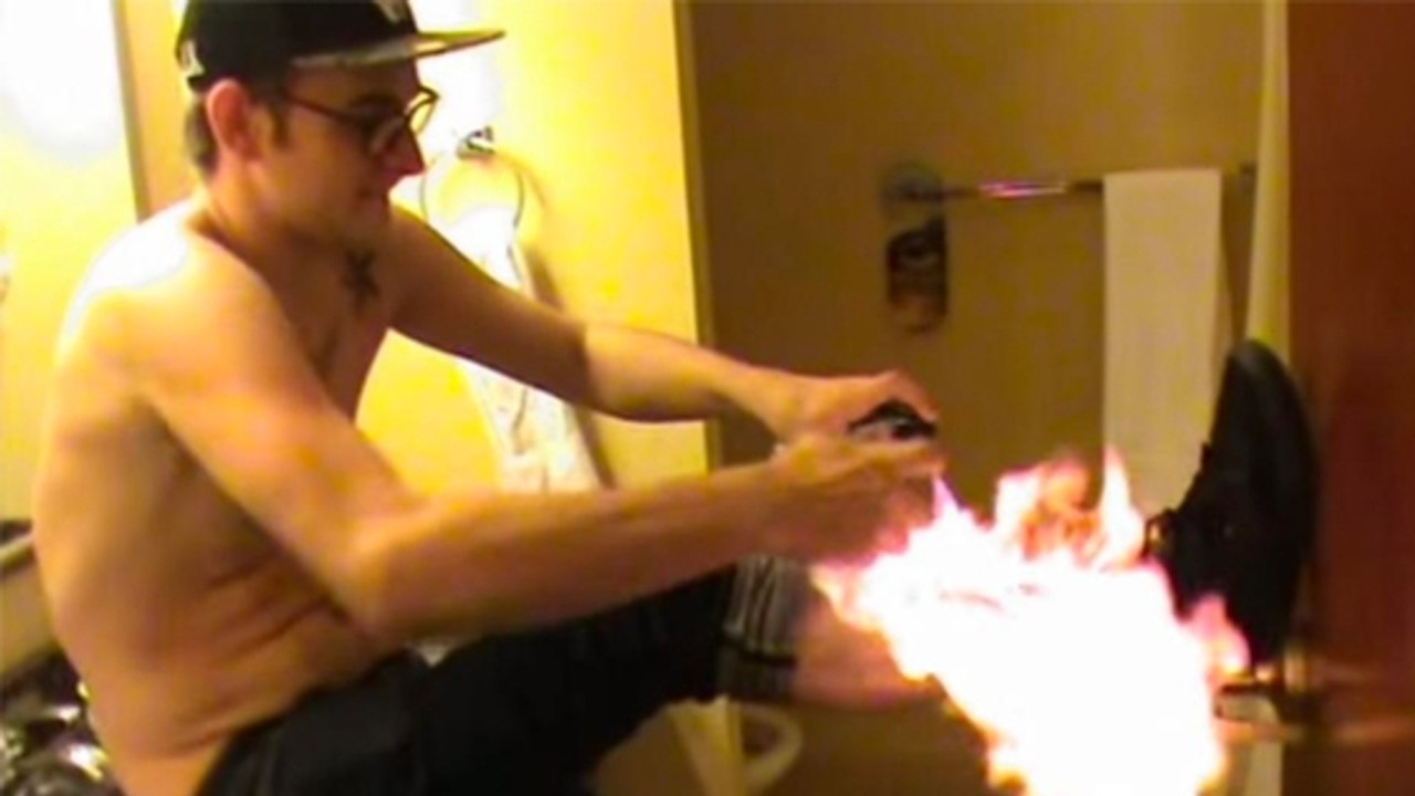 „Fire Challenge“: Darum gefährden Jugendliche ihre Gesundheit