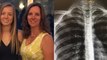 Tochter hat Geheimnis vor ihren Eltern: Dann deckt ein Röntgenbild alles auf