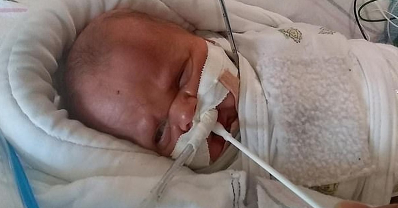 1 % Überlebenschance: Der kleine Rowan kämpft und überrascht alle