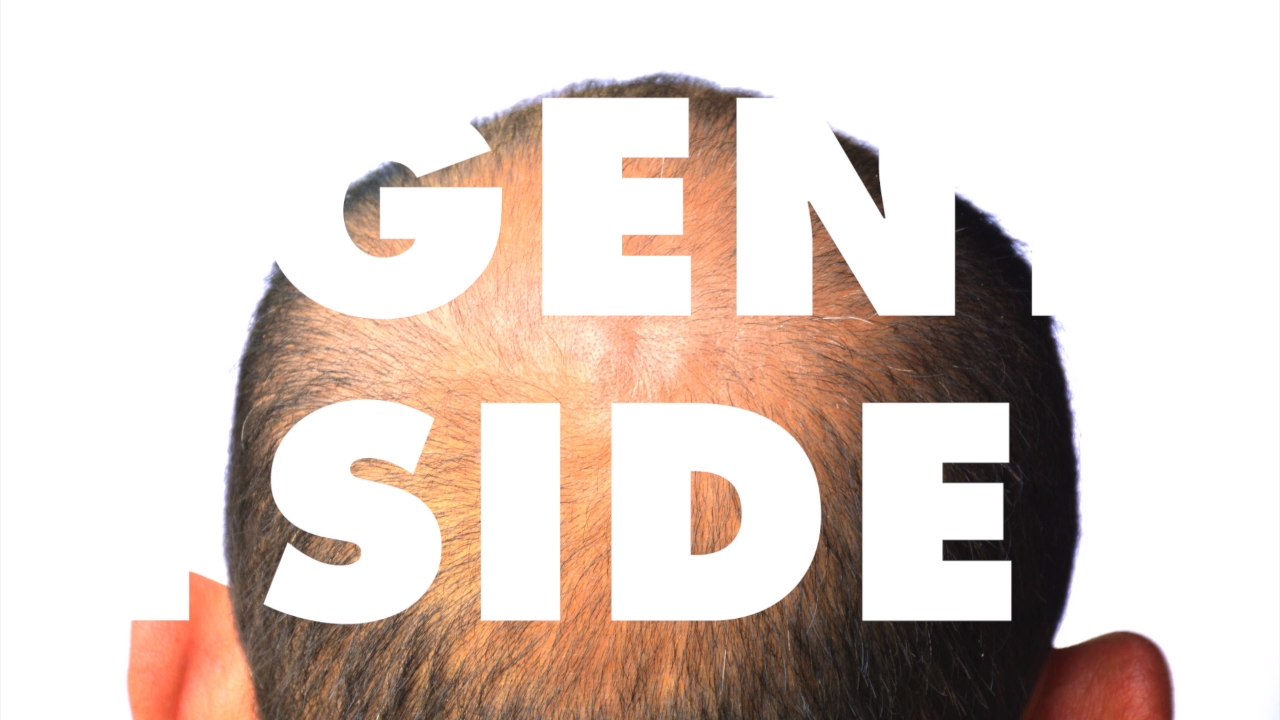 Neue Technik soll es ermöglichen, Haarausfall zu bekämpfen