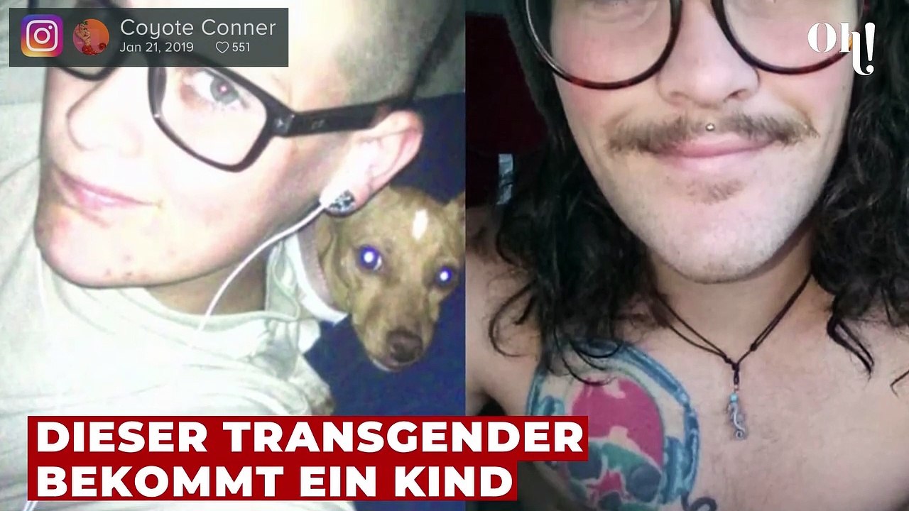 Ärzte sind überrascht: Mann wird plötzlich schwanger