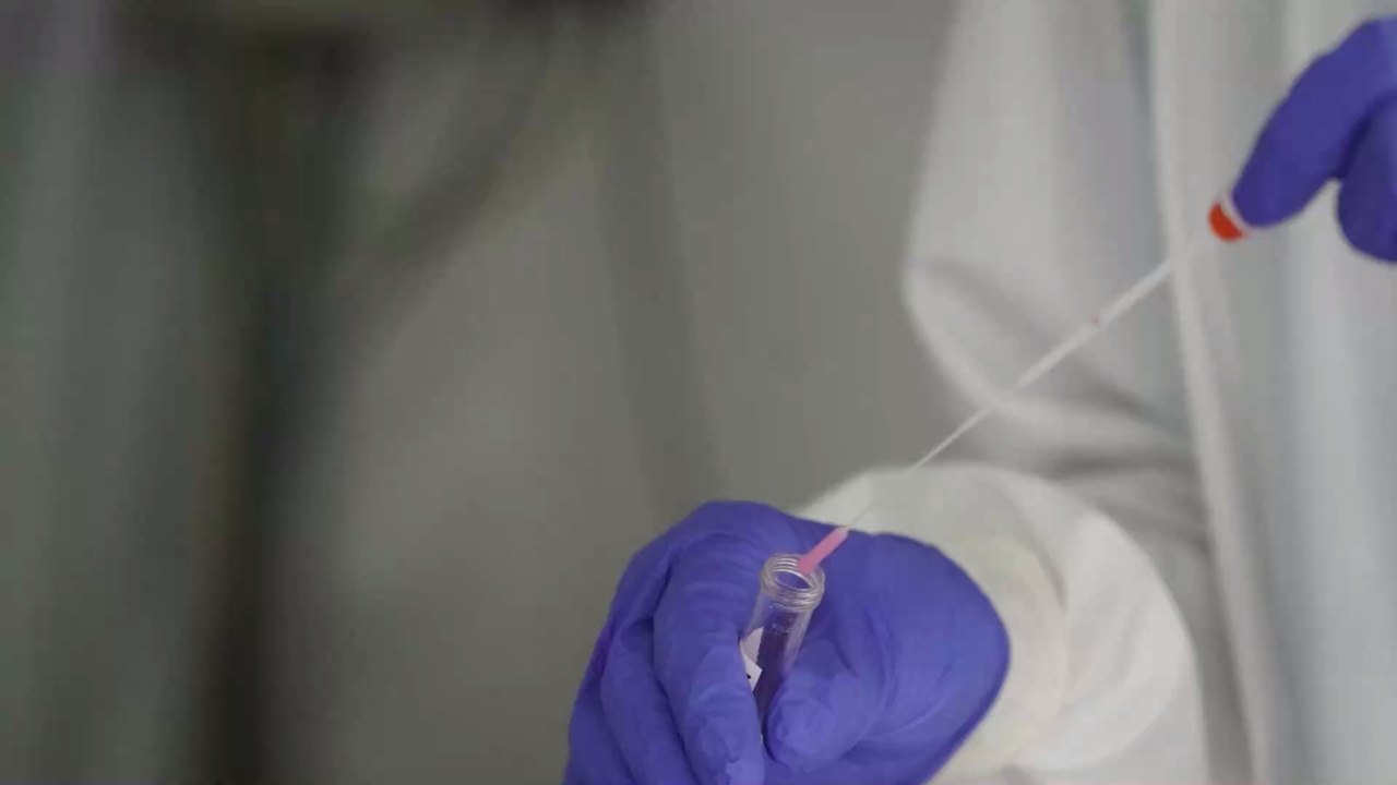 Vitamin K: Begünstigt ein Mangel schwere Covid-19-Verläufe?