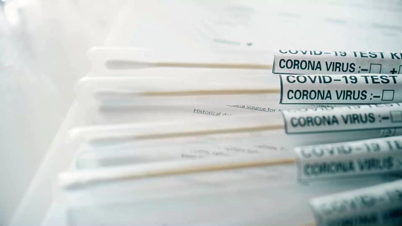 Corona-Schock: Usain Bolt nach Party positiv getestet