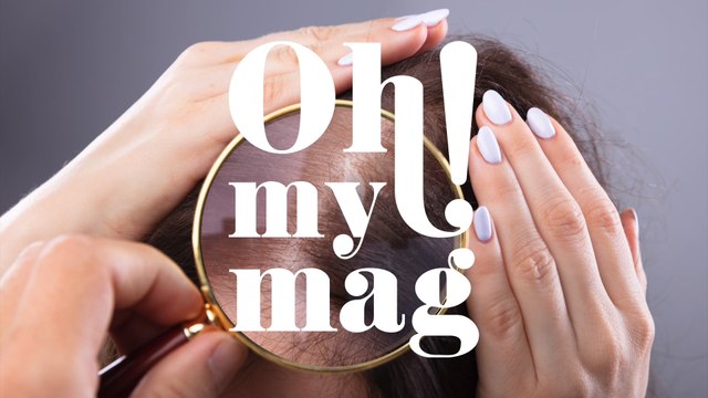 Unterschiedliche Gründe für Haarausfall: Das sind die häufigsten