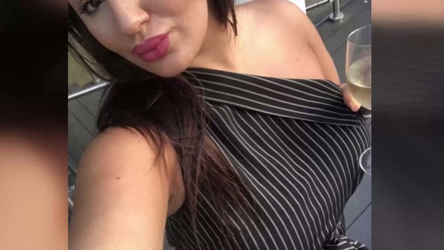 Black head vacuum endorsed by Katie Price leaves woman's face covered in bruises