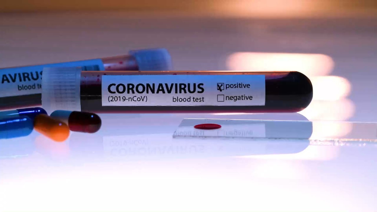 Coronavirus: Eure Blutgruppe verrät, wie hoch das Risiko einer schweren Infektion ist