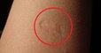 Voici la signification de la petite cicatrice présente sur le bras de certaines personnes