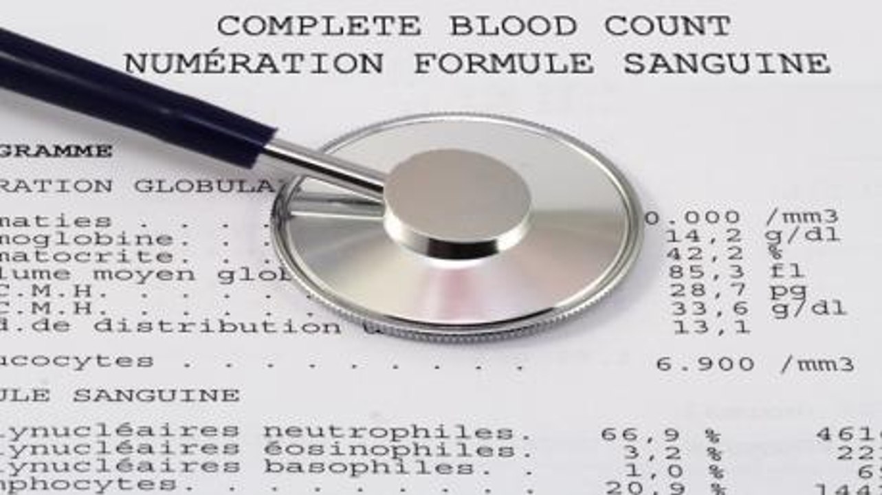NFS ou hémogramme : définition, comment se passe l'examen et quels sont les risques...