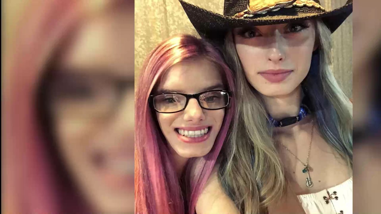 These two twins have one notable difference even doctors can't explain