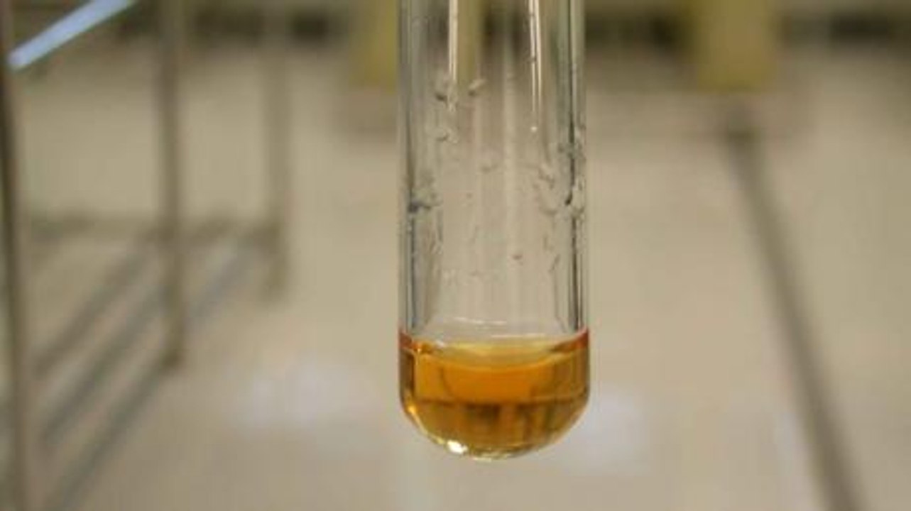 Urée : définition, rôle, comment analyser les résultats ?