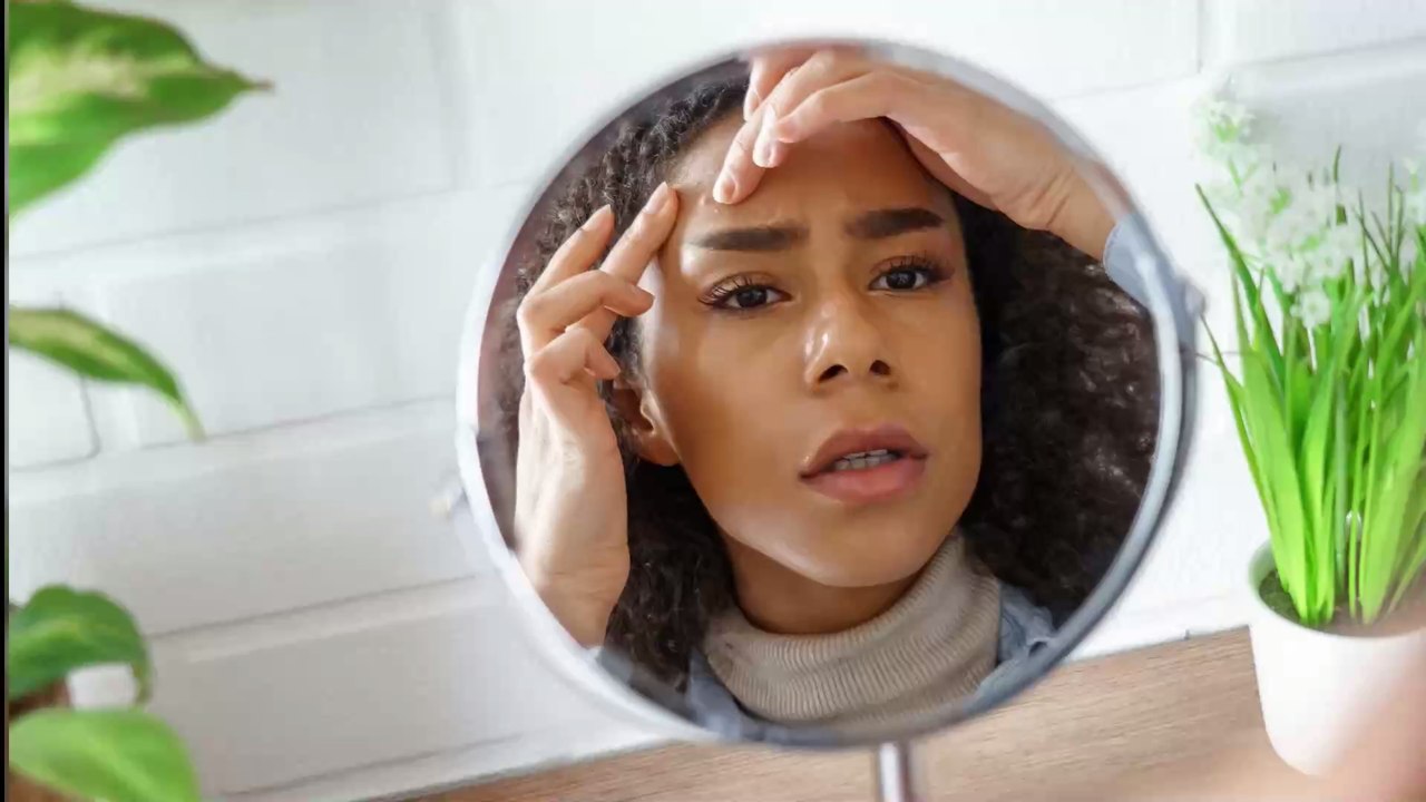 'Ganzes Gesicht entstellt': Frau will Mitesser entfernen, doch das bereut sie schnell