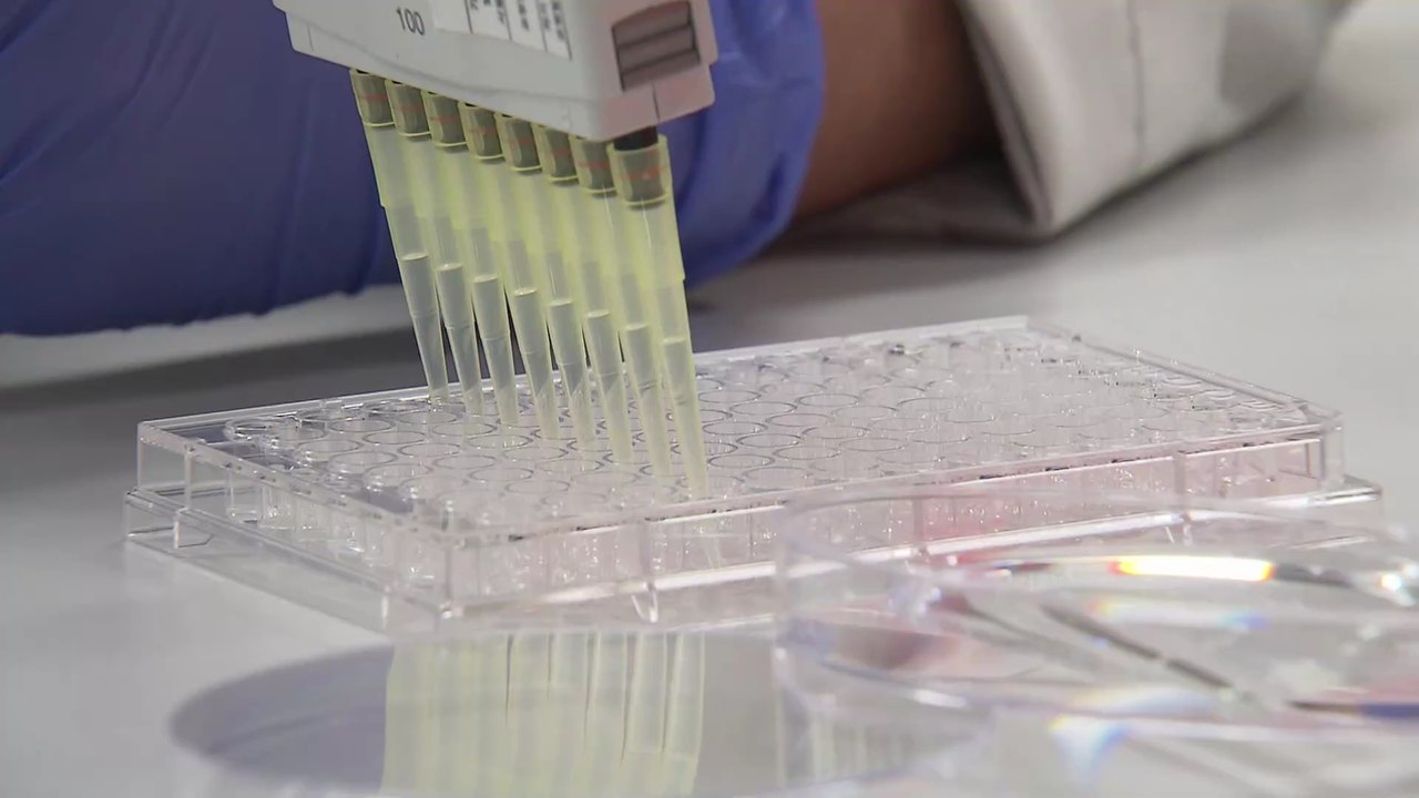 Malawi verzeichnet ersten Fall von heimtückischer Kinderkrankheit, die als ausgerottet gilt