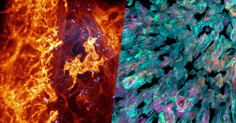 Une technique d'imagerie révolutionnaire offre une nouvelle fenêtre sur le vivant