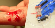 Des chercheurs créent un dispositif capable d'imprimer de la peau pour soigner les blessures profondes