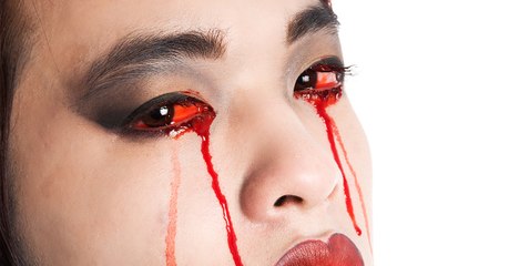 Augeninfektion als Baby: Seit über 20 Jahren tränen ihre Augen Blut