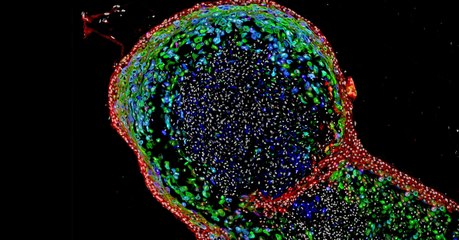 Des chercheurs ont fait pousser un mini-œsophage en laboratoire