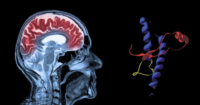 Les chercheurs synthétisent la protéine tueuse du prion en laboratoire