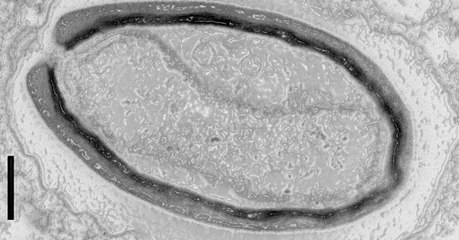 Les pandoravirus, ces virus géants qui forment de nouveaux gènes à partir de leur ADN