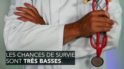 Des sœurs siamoises fusionnées par la tête ont été détachées avec succès