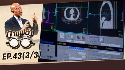 นวัตกรรมใหม่ โรงพยาบาลหัวใจกรุงเทพ | กาแฟดำ EP43 (3/3) | สุทธิชัย หยุ่น