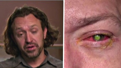 Cet homme est devenu aveugle à cause d'un petit oubli. Et ça pourrait arriver à tout le monde !