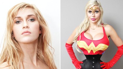 Pour ressembler à Jessica Rabbit, elle subit 15 opérations et se fait retirer 6 côtes