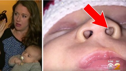 Des tâches noires dans le nez d'un bébé provoquées par un produit que l'on utilise tous