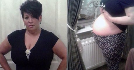 Cette femme a subi une "grossesse" de 3 ans... Ce qui sort de son ventre est affreux !