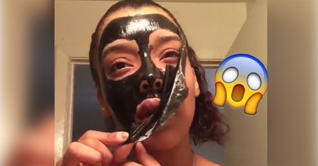 Elle pose un masque au charbon sur son visage pour lutter contre les points noirs et n'arrive plus à l'enlever