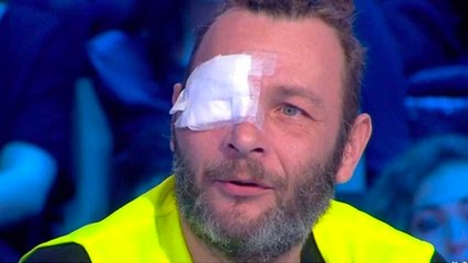 "J'ai tellement la haine" : un "gilet jaune" ayant perdu un oeil se confie chez Thierry Ardisson