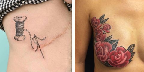 Tatouage : Elles transforment leurs cicatrices en art