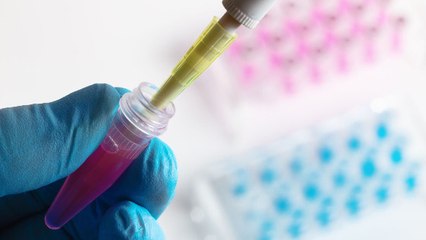 Test génétique pour éviter les cancers héréditaires : ça concerne qui ?