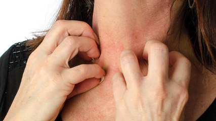Une femme a failli mourir d'une allergie au sperme